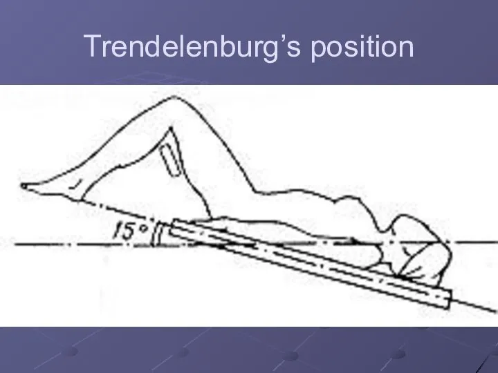 Trendelenburg’s position