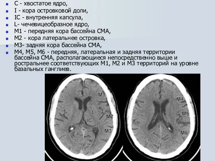 C - хвостатое ядро, I - кора островковой доли, IC