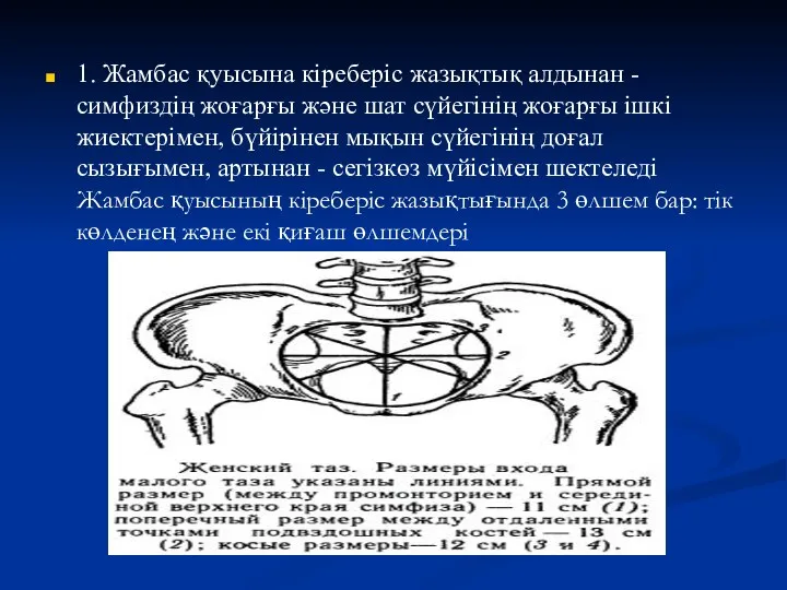 1. Жамбас қуысына кіреберіс жазықтық алдынан - симфиздің жоғарғы және