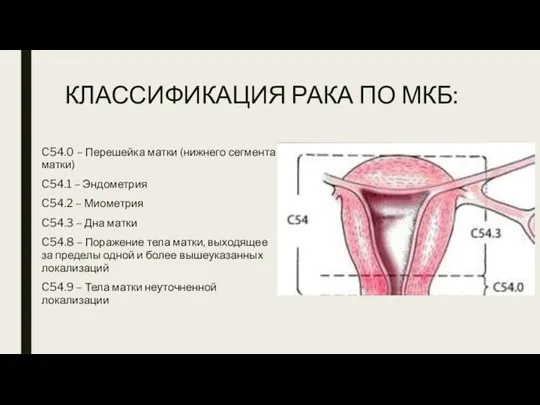 КЛАССИФИКАЦИЯ РАКА ПО МКБ: C54.0 – Перешейка матки (нижнего сегмента