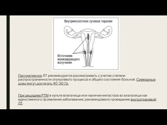 Паллиативную ЛТ рекомендуется рассматривать с учетом степени распространенности опухолевого процесса