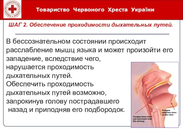 Товариство Червоного Хреста України ШАГ 2. Обеспечение проходимости дыхательных путей.