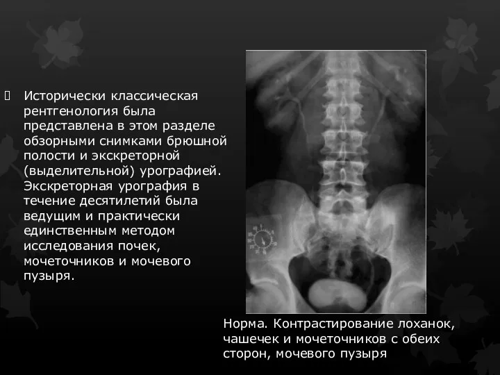 Исторически классическая рентгенология была представлена в этом разделе обзорными снимками