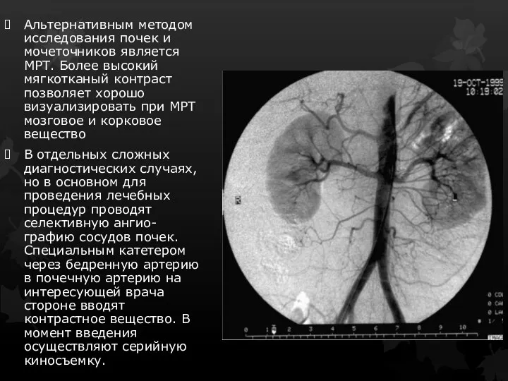 Альтернативным методом исследования почек и мочеточников является МРТ. Более высокий