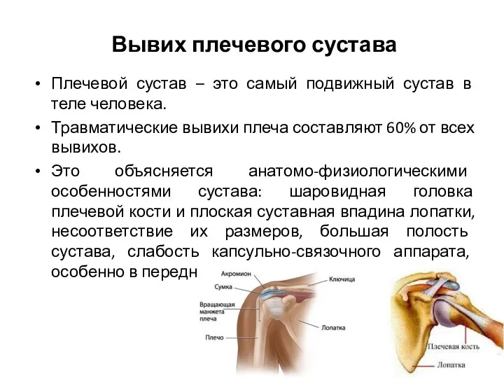 Вывих плечевого сустава Плечевой сустав – это самый подвижный сустав