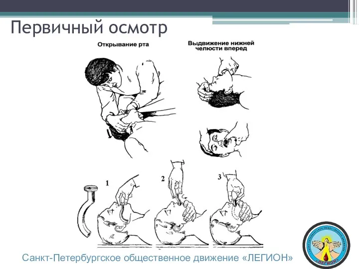 Первичный осмотр Санкт-Петербургское общественное движение «ЛЕГИОН»