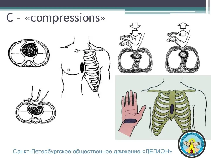 C – «compressions» Санкт-Петербургское общественное движение «ЛЕГИОН»