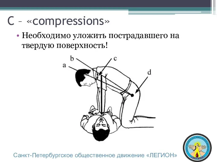 C – «compressions» Необходимо уложить пострадавшего на твердую поверхность! Санкт-Петербургское общественное движение «ЛЕГИОН»