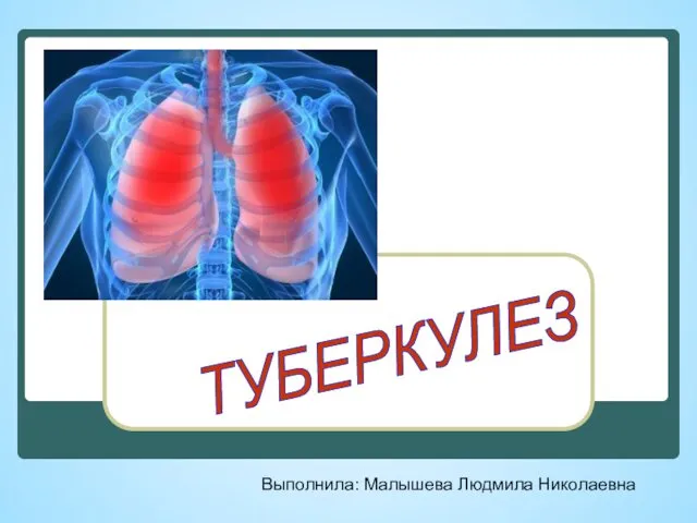 Туберкулез: угроза для всей планеты