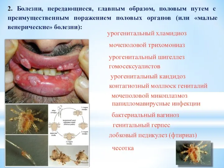 2. Болезни, передающиеся, главным образом, половым путем с преимущественным поражением