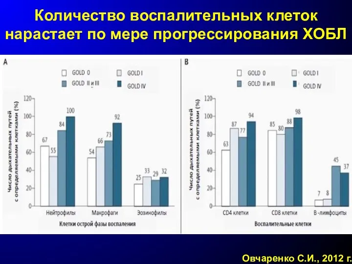 Количество воспалительных клеток нарастает по мере прогрессирования ХОБЛ Овчаренко С.И., 2012 г.