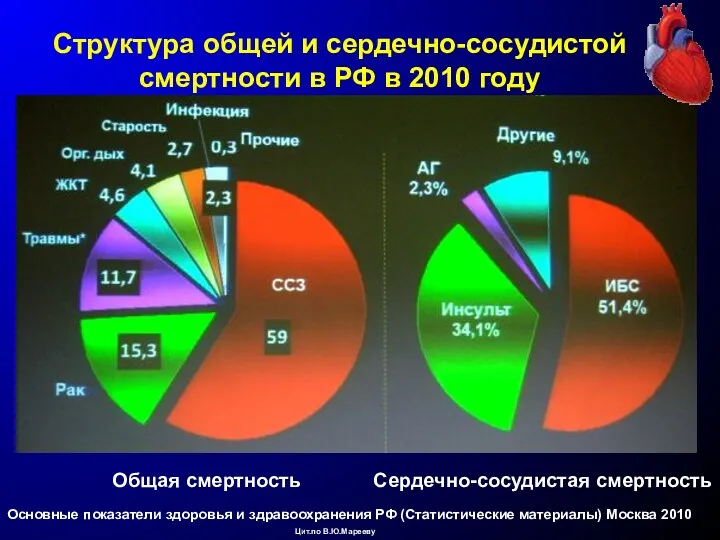 Структура общей и сердечно-сосудистой смертности в РФ в 2010 году Основные показатели здоровья