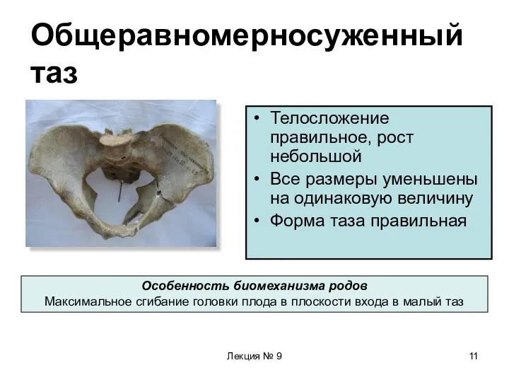 Лекция № 9 Общеравномерносуженный таз Телосложение правильное, рост небольшой Все