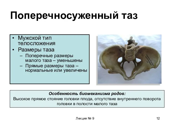 Лекция № 9 Поперечносуженный таз Мужской тип телосложения Размеры таза Поперечные размеры малого