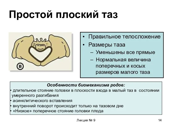 Лекция № 9 Простой плоский таз Правильное телосложение Размеры таза Уменьшены все прямые