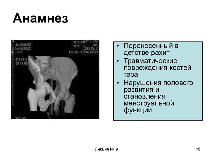 Лекция № 9 Анамнез Перенесенный в детстве рахит Травматические повреждения костей таза Нарушения