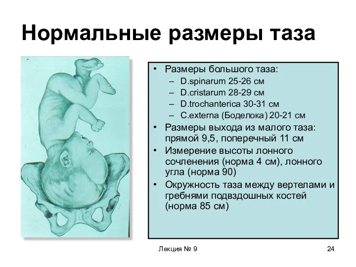 Лекция № 9 Нормальные размеры таза Размеры большого таза: D.spinarum 25-26 см D.cristarum