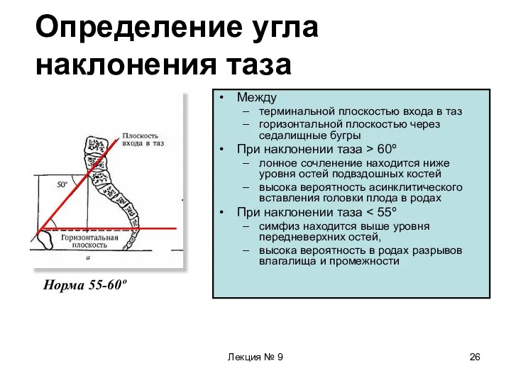 Лекция № 9 Определение угла наклонения таза Между терминальной плоскостью