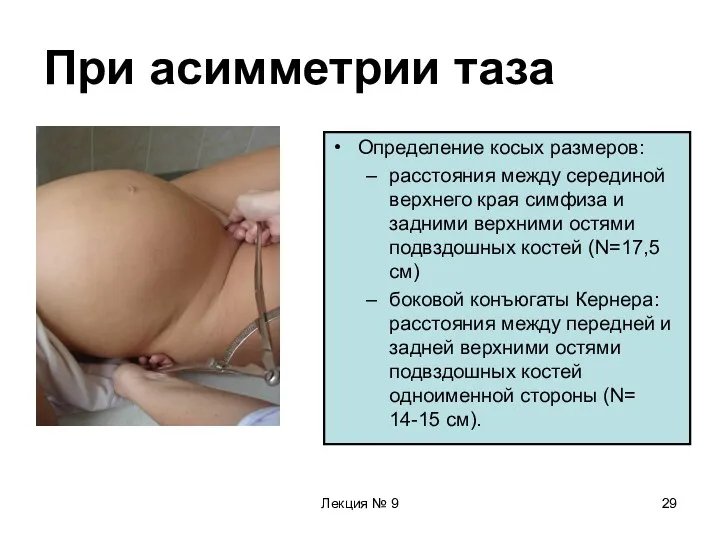 Лекция № 9 При асимметрии таза Определение косых размеров: расстояния между серединой верхнего