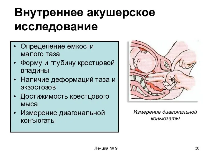 Лекция № 9 Внутреннее акушерское исследование Определение емкости малого таза