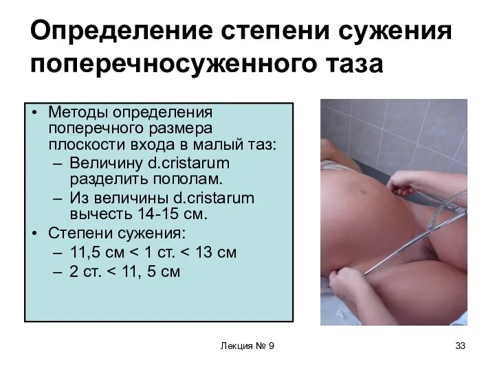 Лекция № 9 Определение степени сужения поперечносуженного таза Методы определения