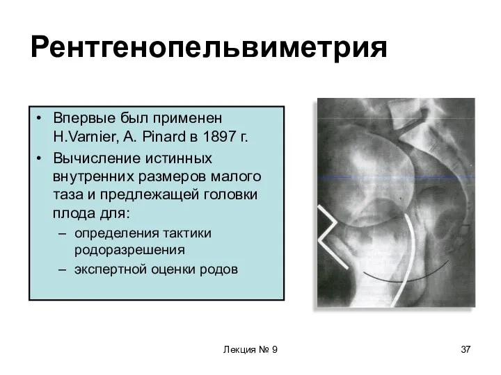 Лекция № 9 Рентгенопельвиметрия Впервые был применен H.Varnier, A. Pinard в 1897 г.