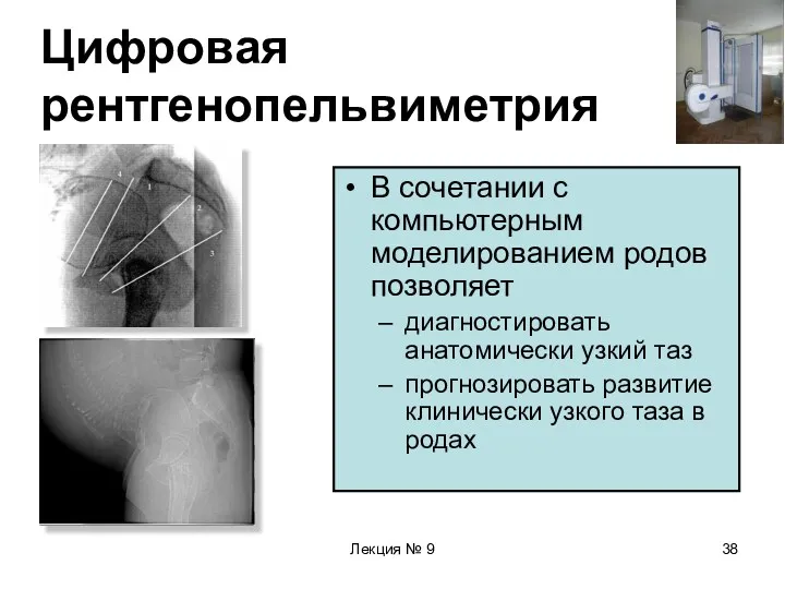 Лекция № 9 Цифровая рентгенопельвиметрия В сочетании с компьютерным моделированием родов позволяет диагностировать