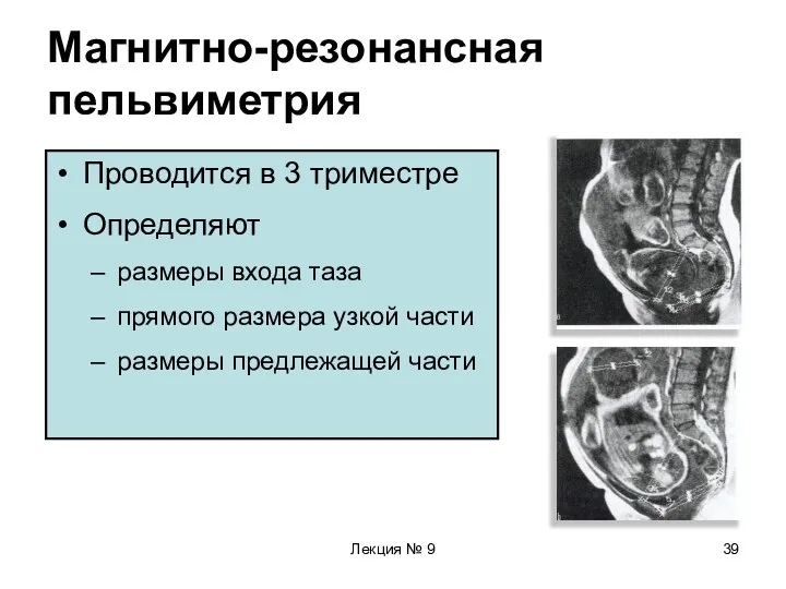 Лекция № 9 Магнитно-резонансная пельвиметрия Проводится в 3 триместре Определяют