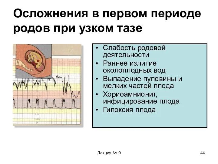 Лекция № 9 Осложнения в первом периоде родов при узком