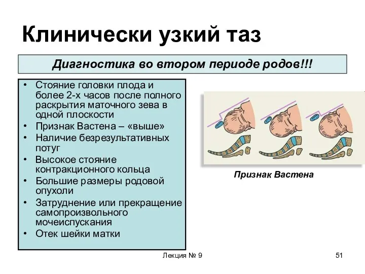 Лекция № 9 Клинически узкий таз Стояние головки плода и