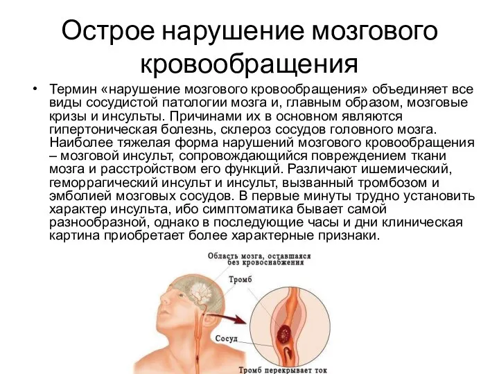 Острое нарушение мозгового кровообращения Термин «нарушение мозгового кровообращения» объединяет все