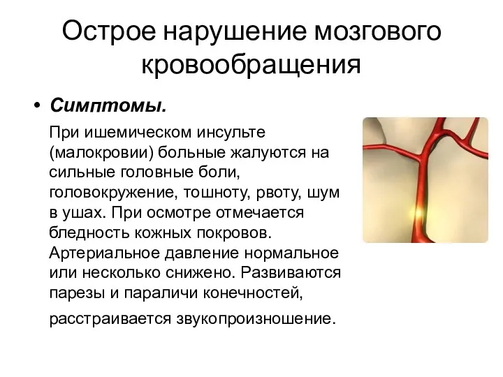 Острое нарушение мозгового кровообращения Симптомы. При ишемическом инсульте (малокровии) больные