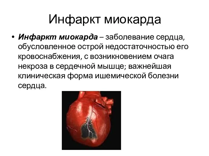 Инфаркт миокарда Инфаркт миокарда – заболевание сердца, обусловленное острой недостаточностью