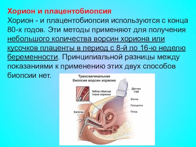 Хорион и плацентобиопсия Хорион - и плацентобиопсия используются с конца