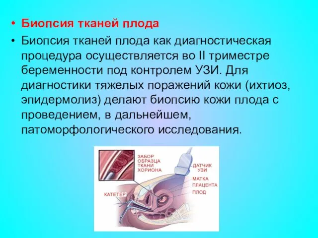 Биопсия тканей плода Биопсия тканей плода как диагностическая процедура осуществляется