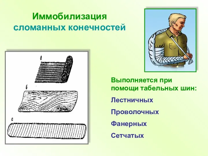 Иммобилизация сломанных конечностей Выполняется при помощи табельных шин: Лестничных Проволочных Фанерных Сетчатых