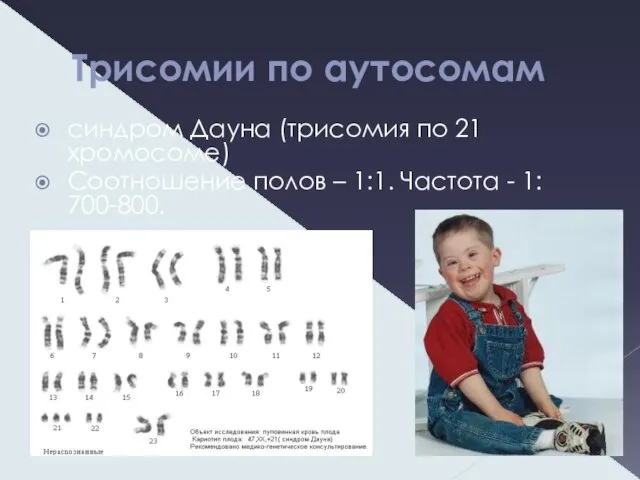 Трисомии по аутосомам синдром Дауна (трисомия по 21 хромосоме) Соотношение