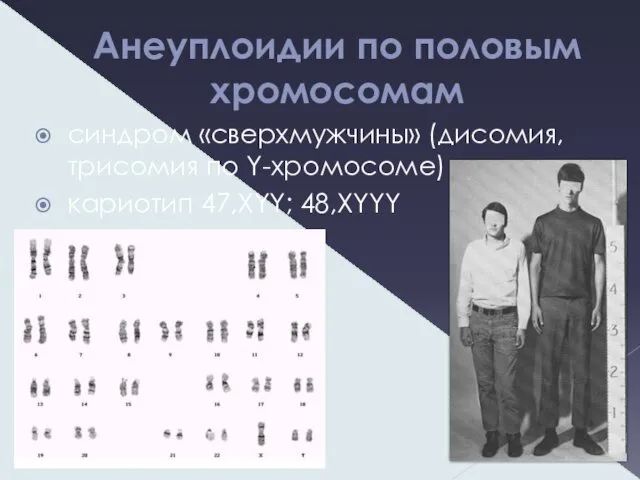 Анеуплоидии по половым хромосомам синдром «сверхмужчины» (дисомия, трисомия по Y-хромосоме) кариотип 47,XYY; 48,XYYY