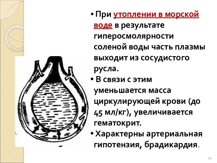 При утоплении в морской воде в результате гиперосмолярности соленой воды