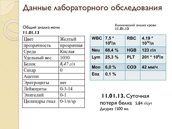 Данные лабораторного обследования Клинический анализ крови 11.01.13 11.01.13. Суточная потеря белка 5,84 г/сут