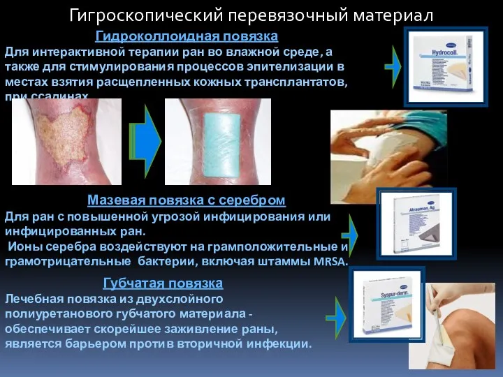 Гигроскопический перевязочный материал Гидроколлоидная повязка Для интерактивной терапии ран во