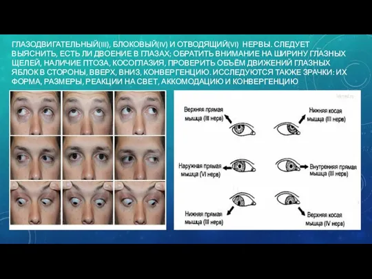 ГЛАЗОДВИГАТЕЛЬНЫЙ(III), БЛОКОВЫЙ(IV) И ОТВОДЯЩИЙ(VI) НЕРВЫ. СЛЕДУЕТ ВЫЯСНИТЬ, ЕСТЬ ЛИ ДВОЕНИЕ