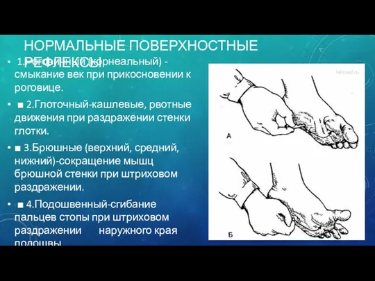 НОРМАЛЬНЫЕ ПОВЕРХНОСТНЫЕ РЕФЛЕКСЫ 1.Роговичный (корнеальный) - смыкание век при прикосновении