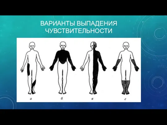 ВАРИАНТЫ ВЫПАДЕНИЯ ЧУВСТВИТЕЛЬНОСТИ