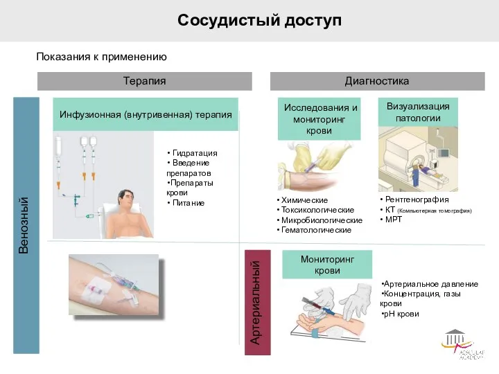 Терапия Диагностика Венозный Артериальный Сосудистый доступ Показания к применению