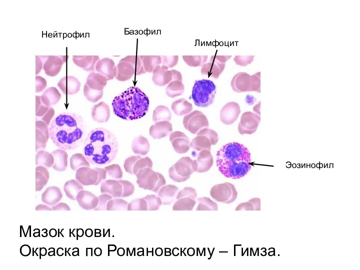 Нейтрофил Базофил Лимфоцит Эозинофил Мазок крови. Окраска по Романовскому – Гимза.