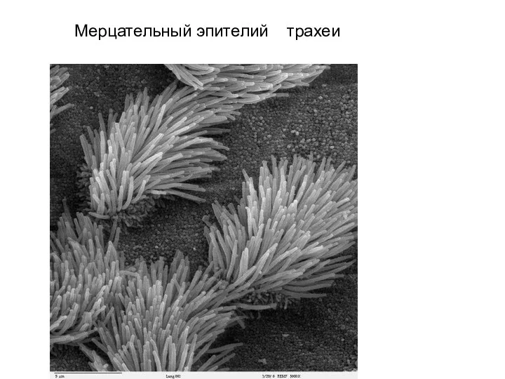 Мерцательный эпителий трахеи