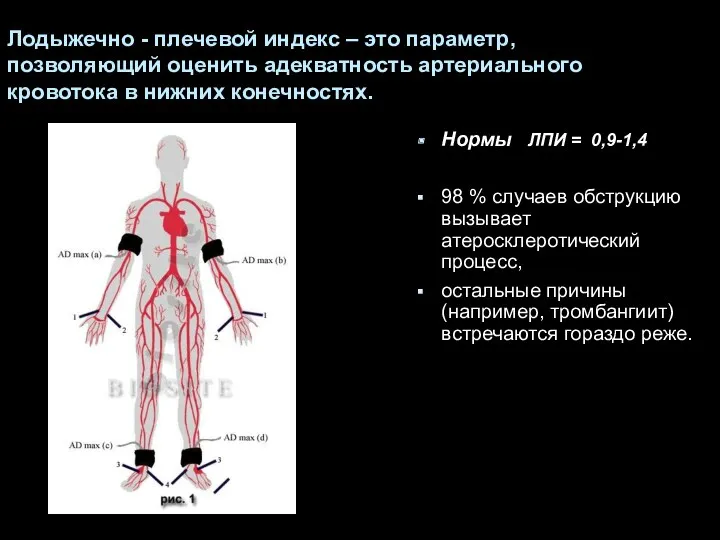 Лодыжечно - плечевой индекс – это параметр, позволяющий оценить адекватность артериального кровотока в