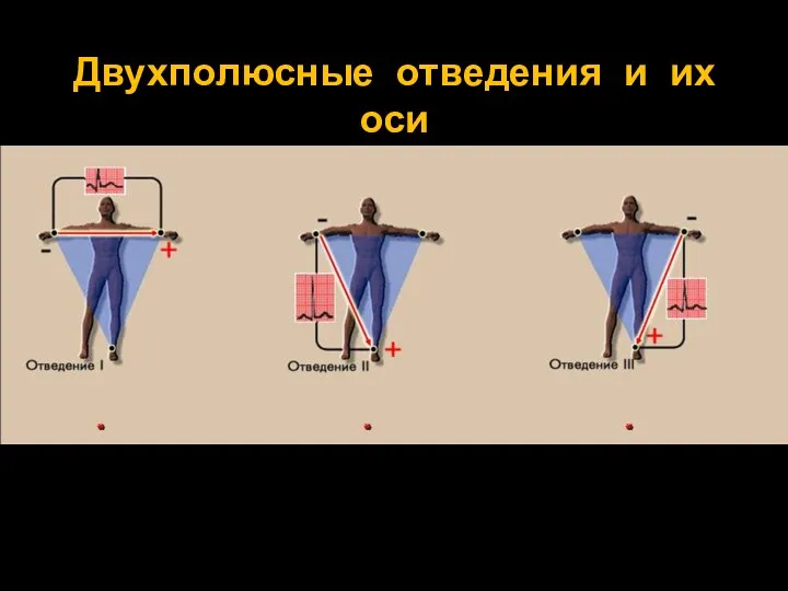 Двухполюсные отведения и их оси