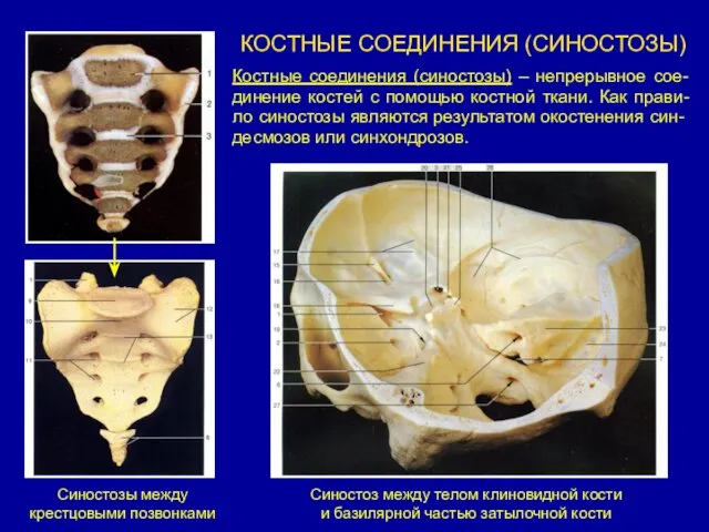 КОСТНЫЕ СОЕДИНЕНИЯ (СИНОСТОЗЫ) Костные соединения (синостозы) – непрерывное сое-динение костей